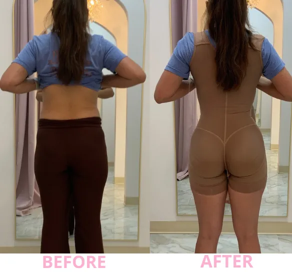 Before and after comparison showing the sculpting effect of the shapewear